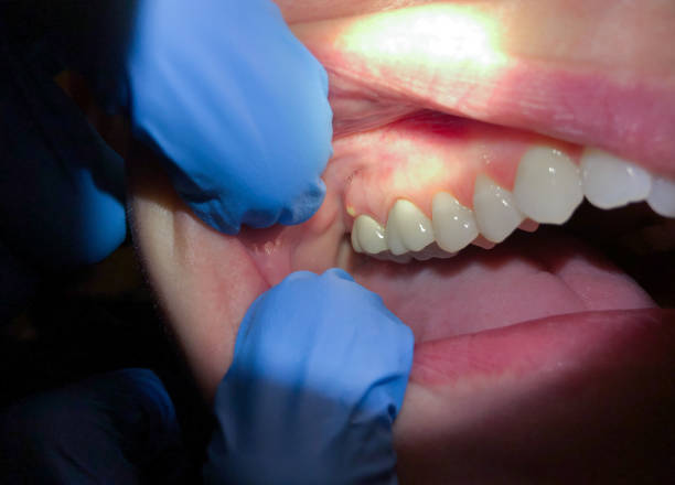 Best Mobile Emergency Dentist in Pemberwick, CT